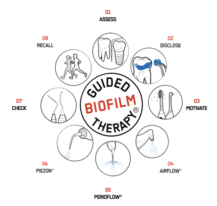 Airflow guided biofilm therapy ako funguje
